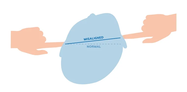Ear alignment test illustration