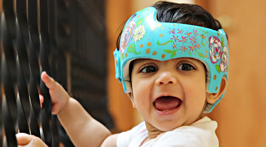 Cranial Technologies - Check out this DOC Band Baby in the arms of