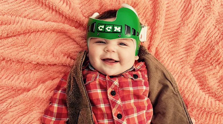 Infant Helmet Therapy Cranial Technologies