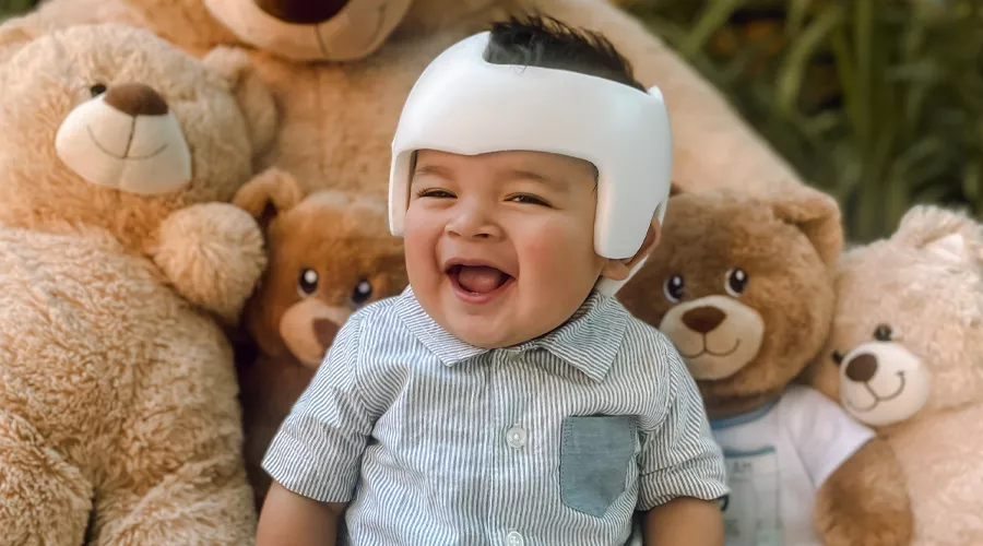 happy baby wearing a DOC Band in front of teddy bears