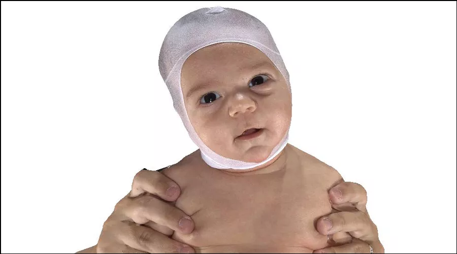 Baby with head tilt caused by torticollis