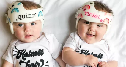 Baby head helmet 2024 cost