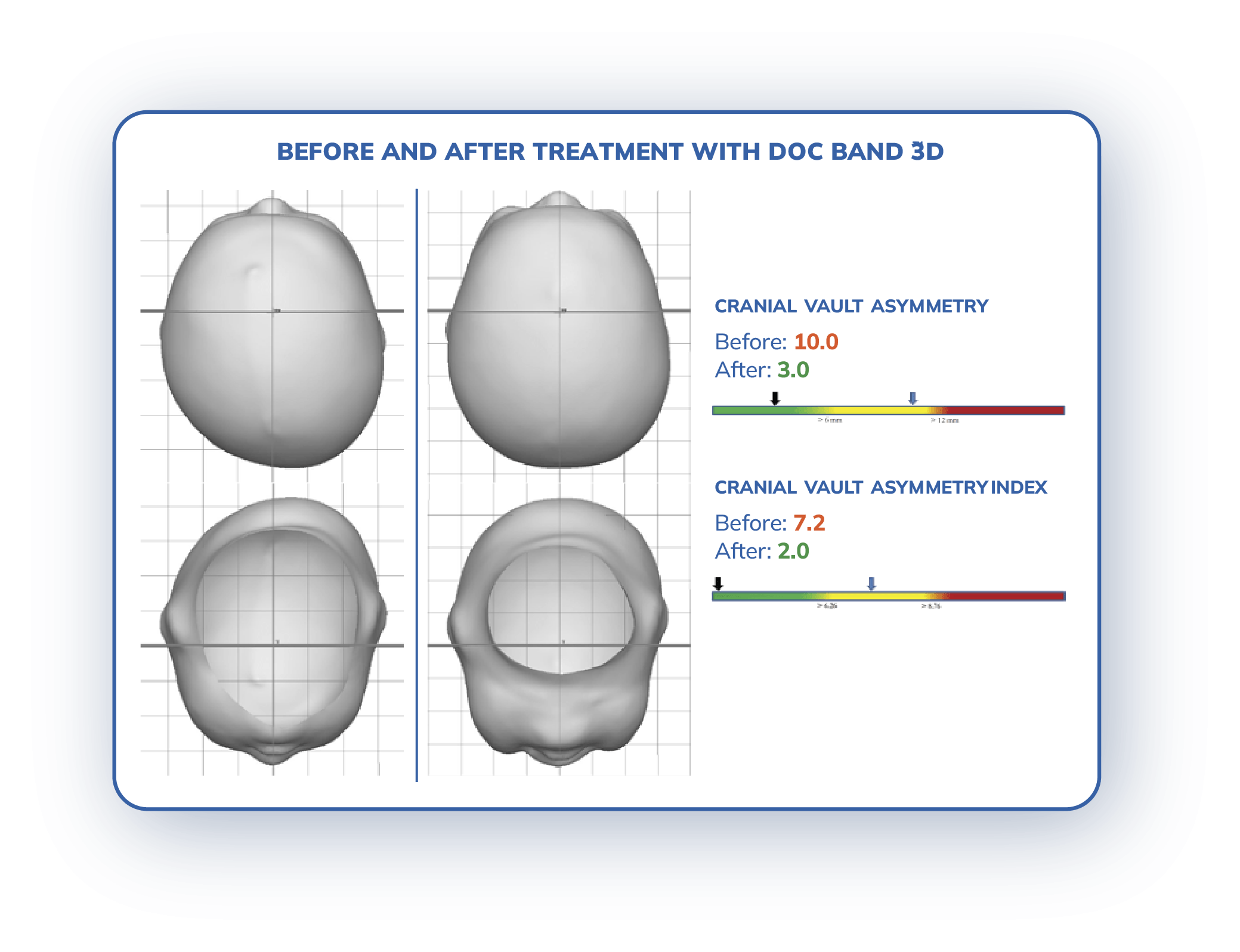 Before and After Treatment