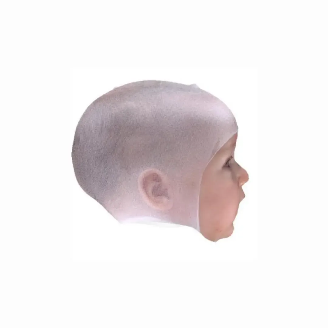 After Treatment