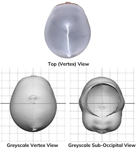 Cranial View Reading a Cranial Scan | Cranial Technologies