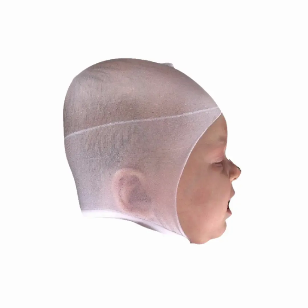 Before Treatment
