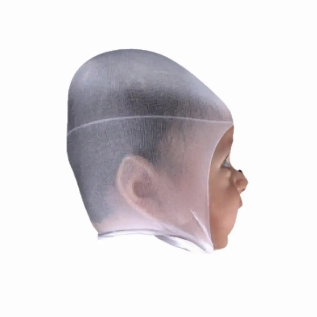 Before Treatment