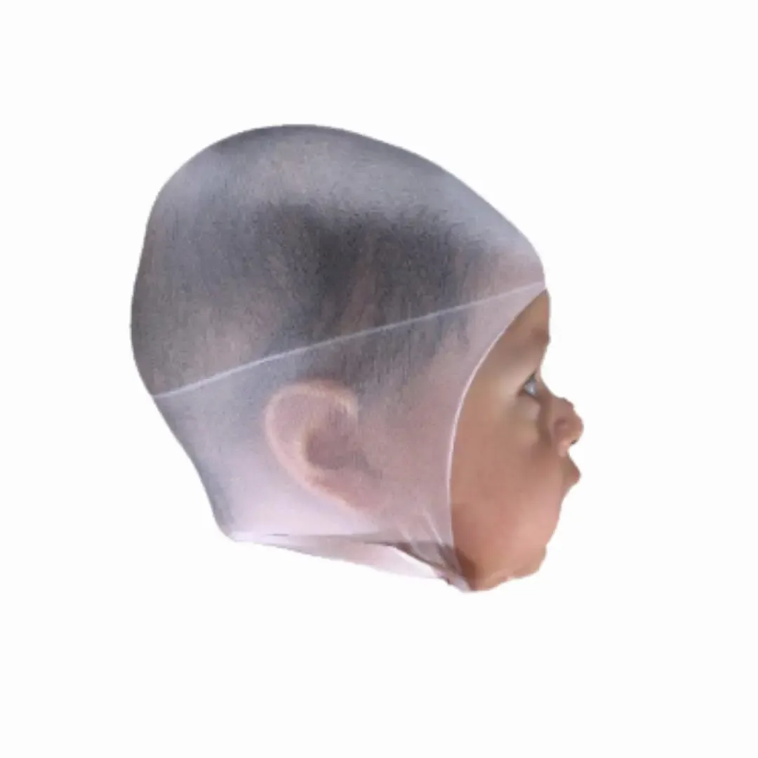 After Treatment