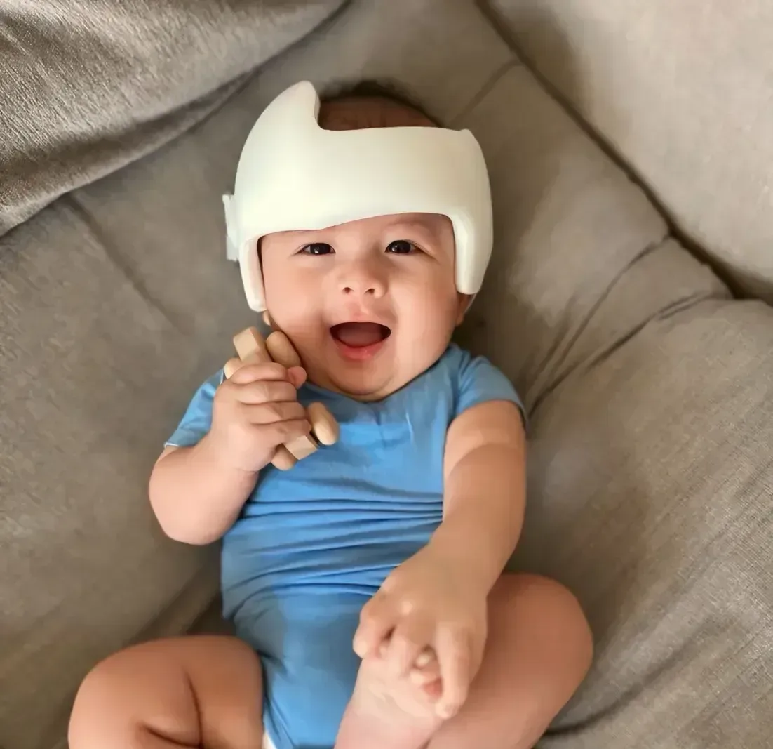 Infant Helmet Therapy | كيف كانت الأيام الأولى مع الخوذة الطبية؟