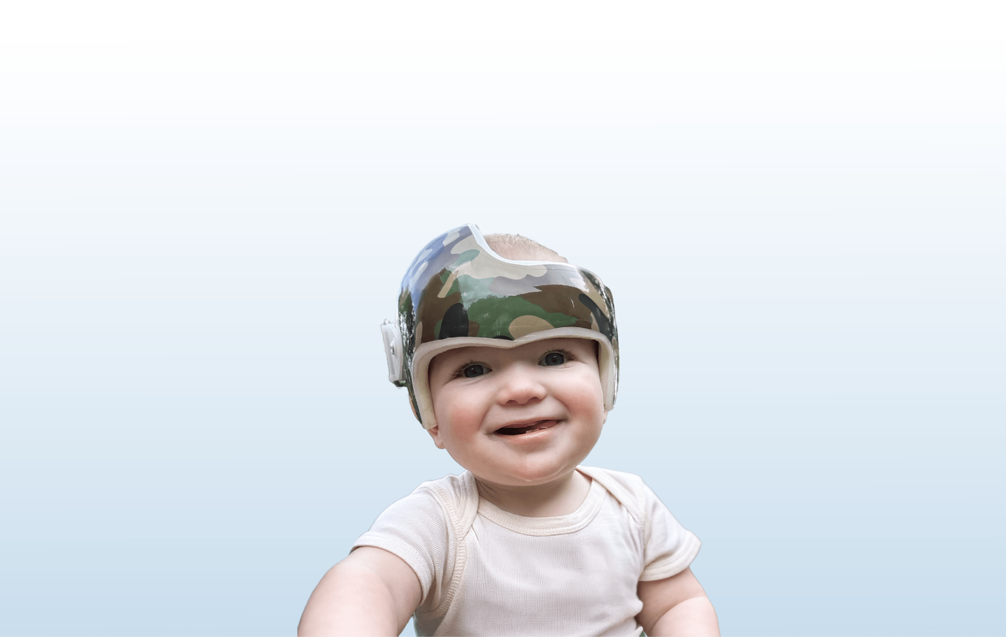Tricare Cranial Remodeling Treatment | Cranial Technologies